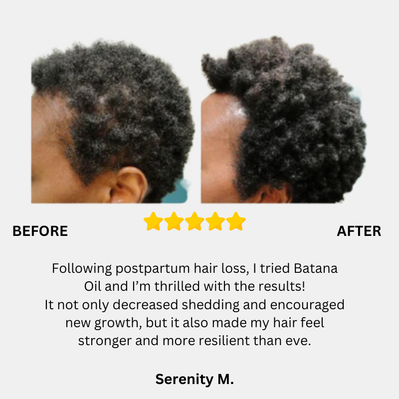 Batana Natural Hair Growth Miracle Oil