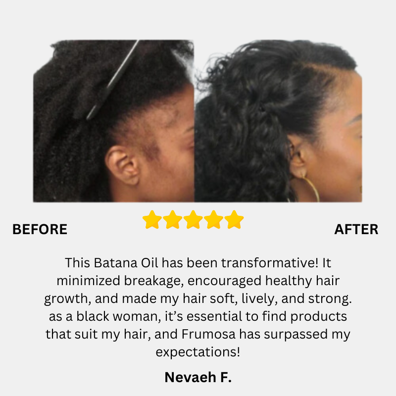 Batana Natural Hair Growth Miracle Oil