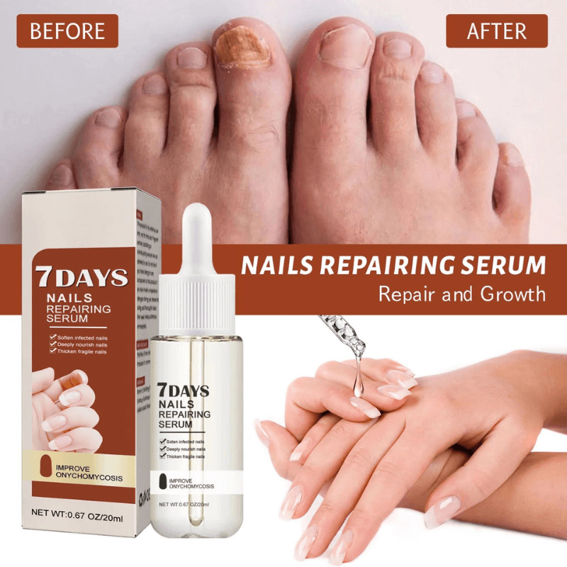 Nail Growth and Strengthening Serum | 1+1 FREE