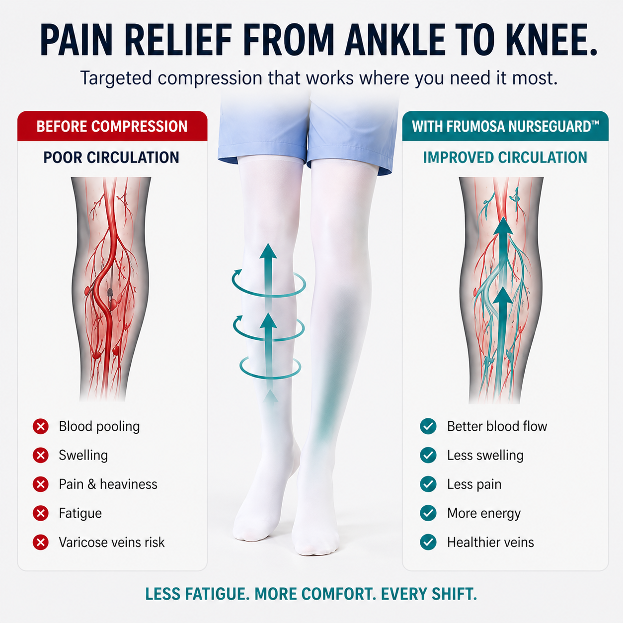 Frumosa Thigh-High Compression Stockings | Knee & Leg Relief